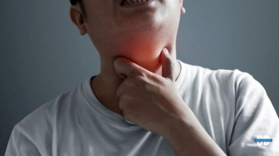 Strep Throat 3